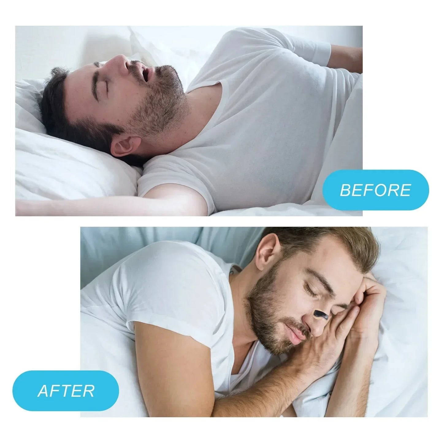 Nasal Strip Kit