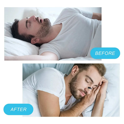 Nasal Strip Kit